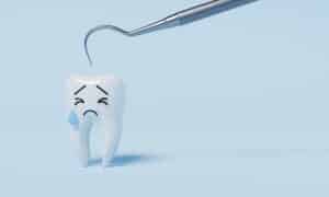 Tooth decay progression and dental fillings in Simi Valley, CA